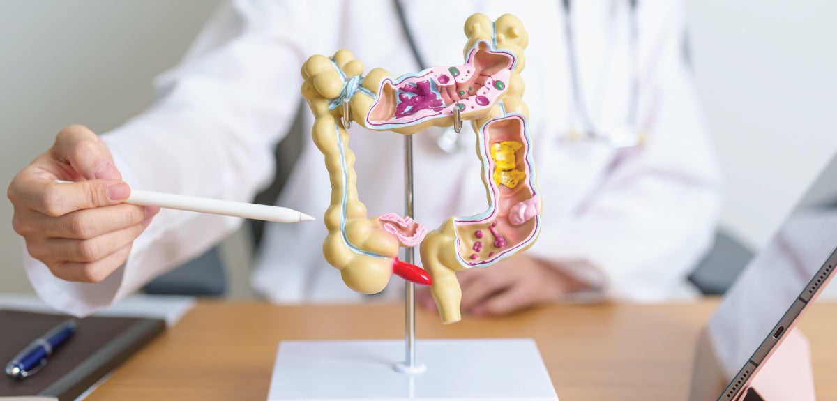 Colon and Rectal Care