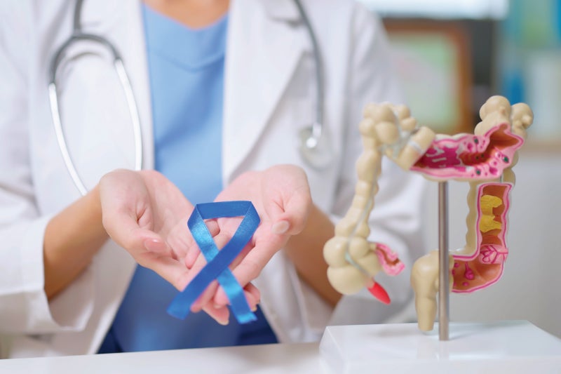 Colonoscopy screening